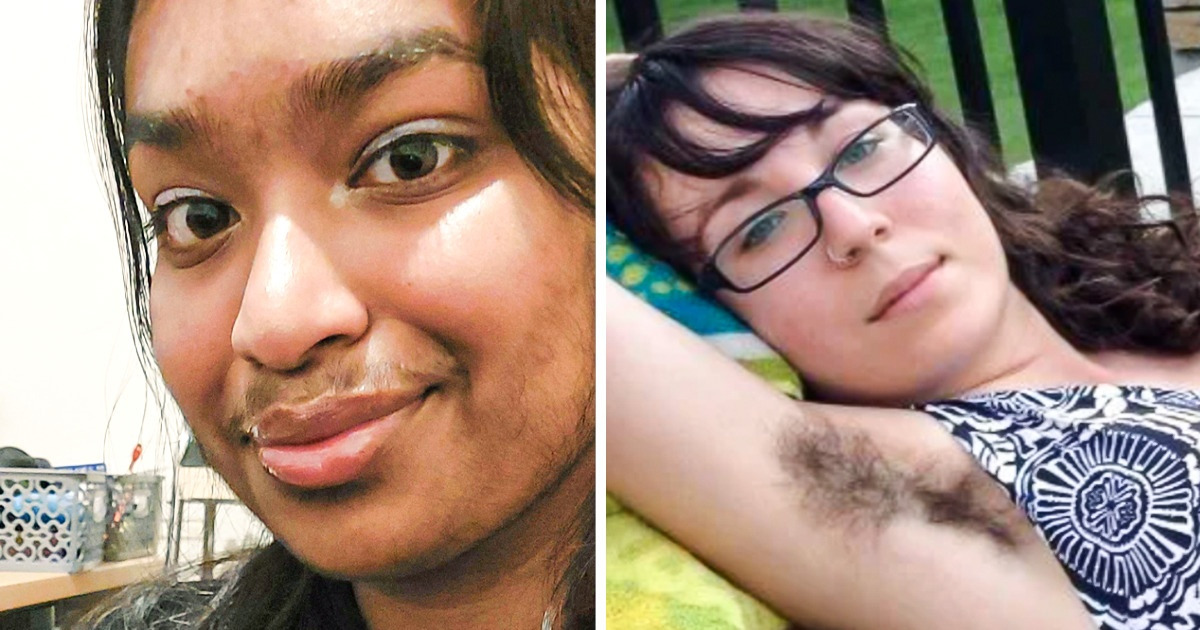 18 Mulheres que se libertaram da preocupação com pelos e estão mais felizes do que nunca