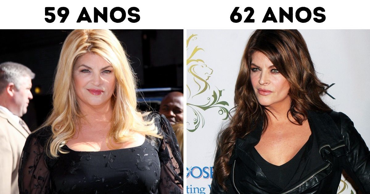 12 Famosos que mudaram incrivelmente depois de perder peso