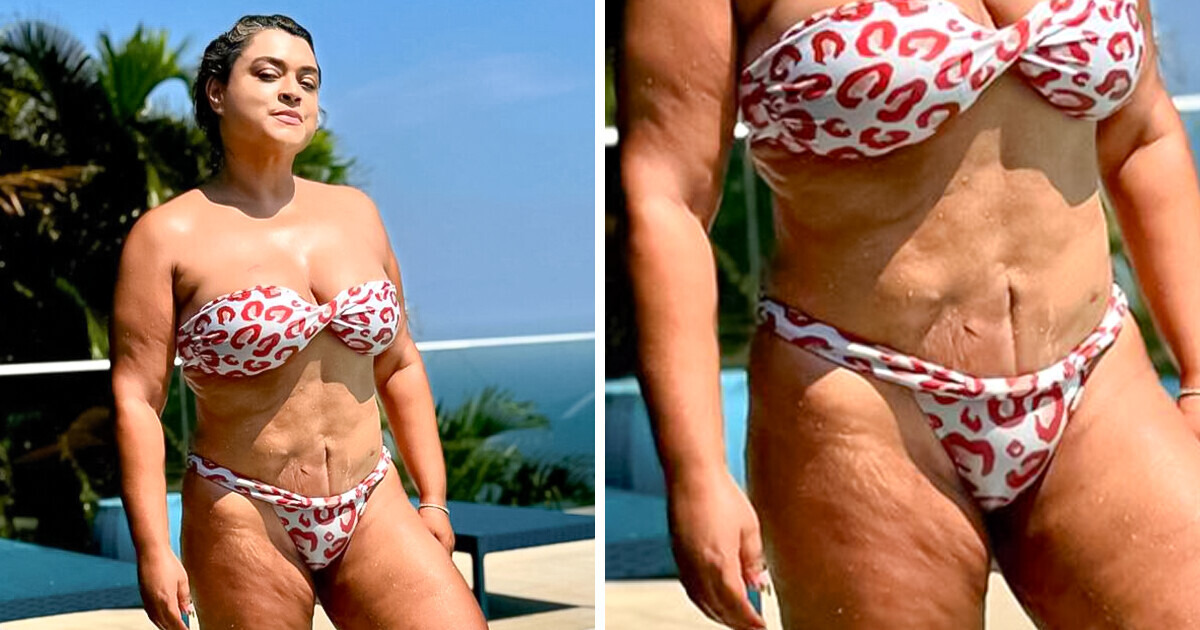 5 Famosas que abandonaram os filtros e mostraram suas "imperfeições"