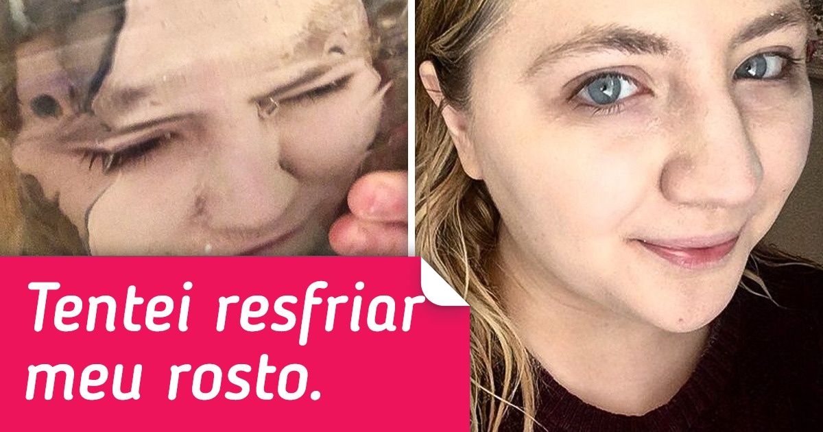 O que pode acontecer com a sua pele se você esfregar gelo no rosto todos os dias