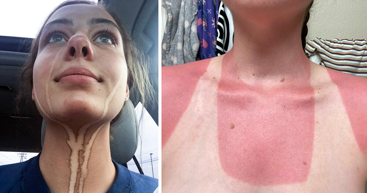 15 Pessoas com um azar tão grande que chega a doer 15 Pessoas com um azar tão grande que chega a doer