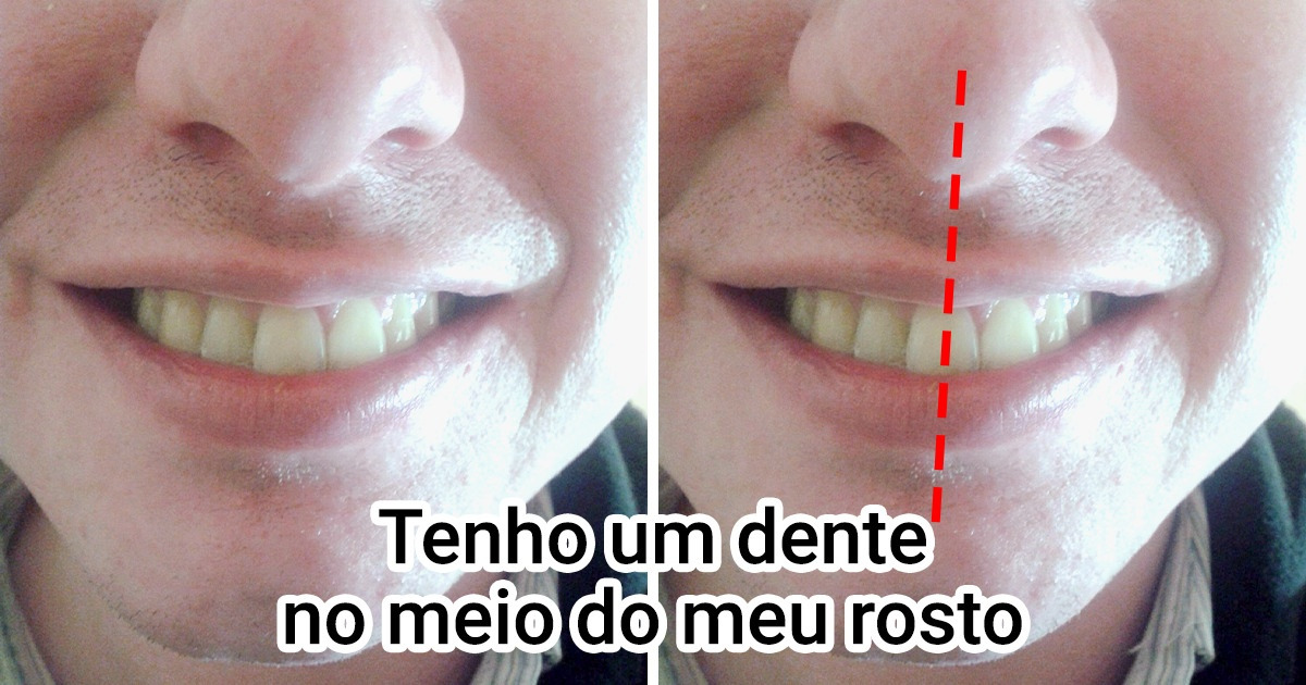 15+ Traços corporais raros, responsáveis por tornar algumas pessoas únicas