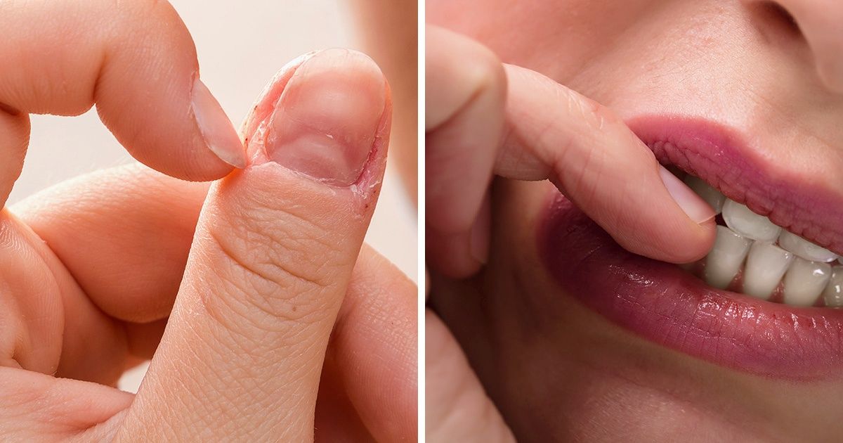 5 Coisas que o hábito de roer as unhas pode dizer a seu respeito