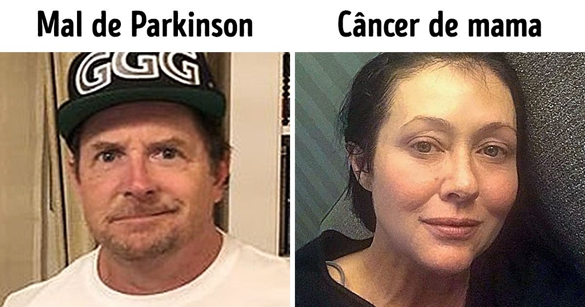 15 Famosos que não se deixaram abater mesmo com doenças graves 15 Famosos que não se deixaram abater mesmo com doenças graves