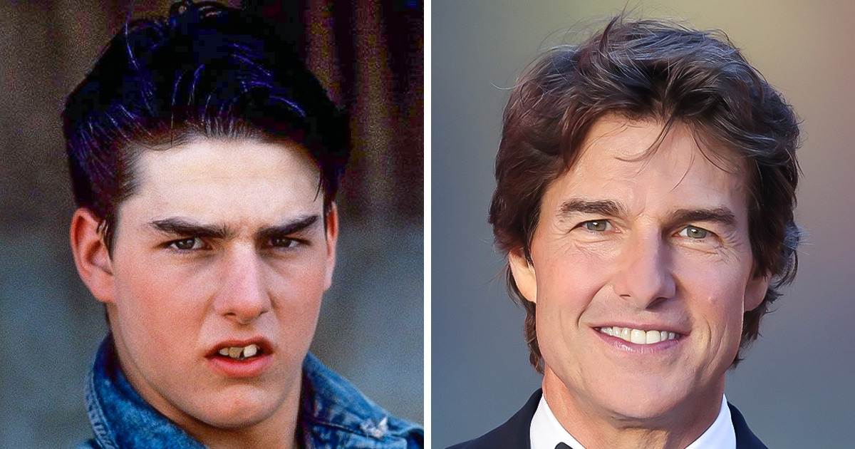 7 Celebridades que passaram por pequenas transformações que mudaram radicalmente sua imagem