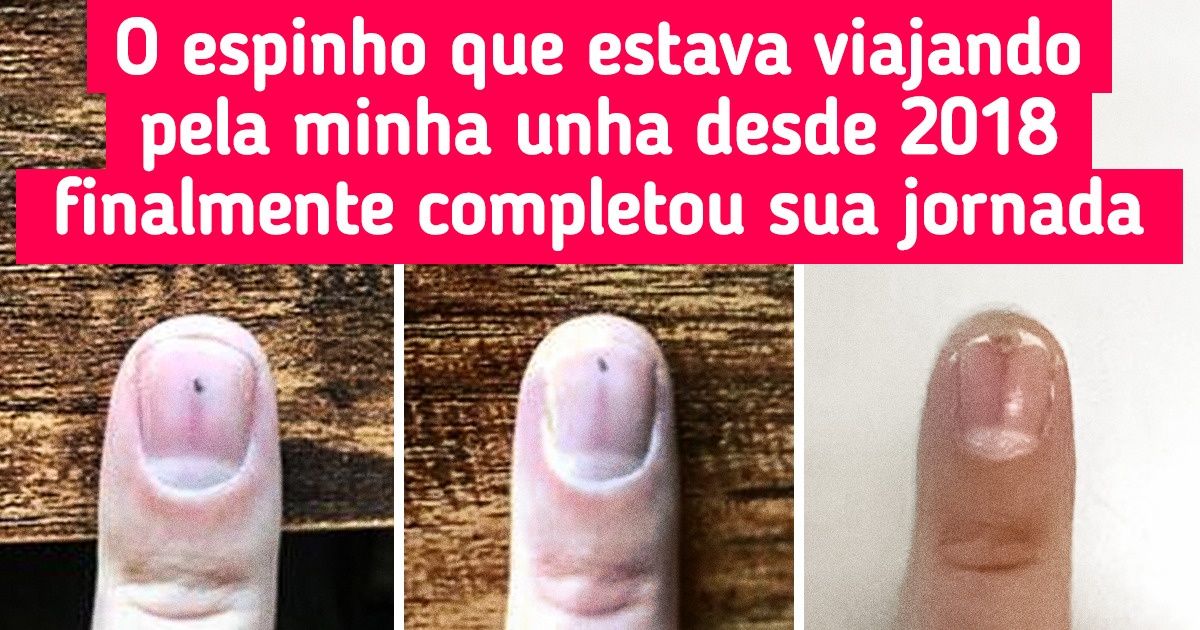 20 Pessoas que viram coisas mais difíceis de acontecer do que ganhar na loteria