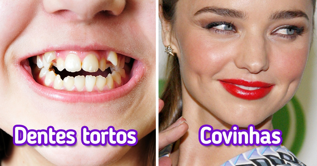 6 Características que geralmente herdamos apenas de nosso pai