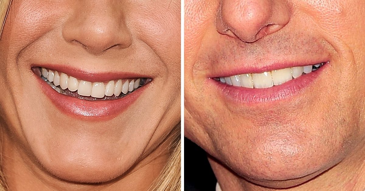 Teste: Você consegue adivinhar quais são as celebridades apenas pelo sorriso?