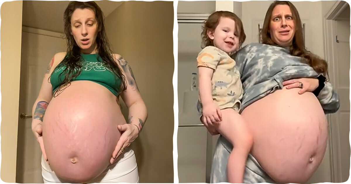 Ninguém acreditou no tamanho da barriga dela — até verem o que saiu no parto Ninguém acreditou no tamanho da barriga dela — até verem o que saiu no parto