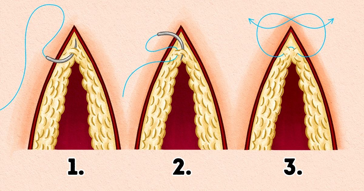 Conhecimentos e habilidades que podem salvar a sua vida na natureza