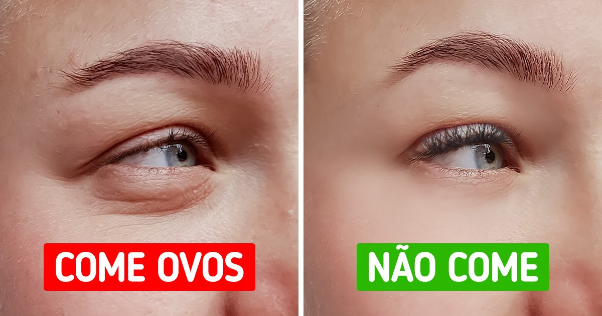 O que poderia acontecer se você parasse de comer ovos