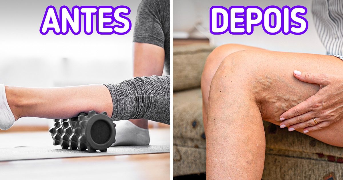 5 Acessórios para fazer exercícios físicos em casa que podem prejudicar mais do que beneficiar 5 Acessórios para fazer exercícios físicos em casa que podem prejudicar mais do que beneficiar