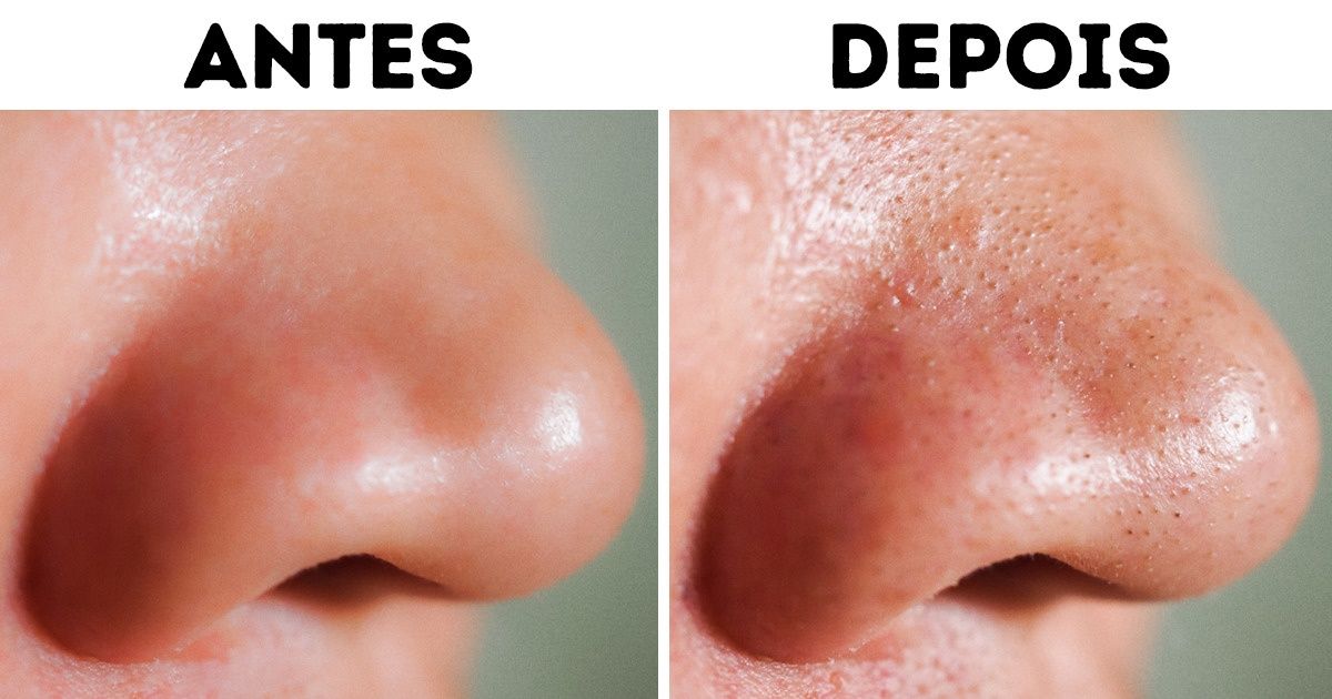 6 Motivos pelos quais os lenços demaquilantes podem ser prejudiciais à pele