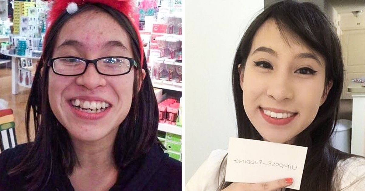 15 Garotas que não gostavam de sua aparência na adolescência, mas mudaram tão radicalmente a ponto de ficar quase irreconhecíveis 15 Garotas que não gostavam de sua aparência na adolescência, mas mudaram tão radicalmente a ponto de ficar quase irreconhecíveis