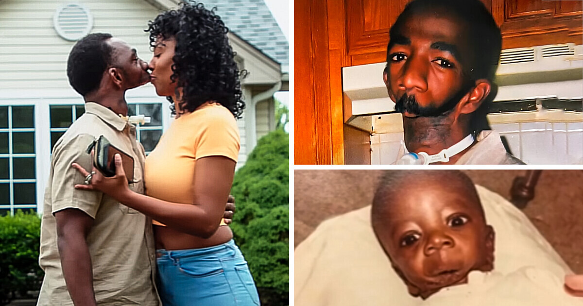 "Ela não pode beijá-lo!" Homem sem mandíbula encontrou o verdadeiro amor e seu relacionamento gera controvérsias "Ela não pode beijá-lo!" Homem sem mandíbula encontrou o verdadeiro amor e seu relacionamento gera controvérsias