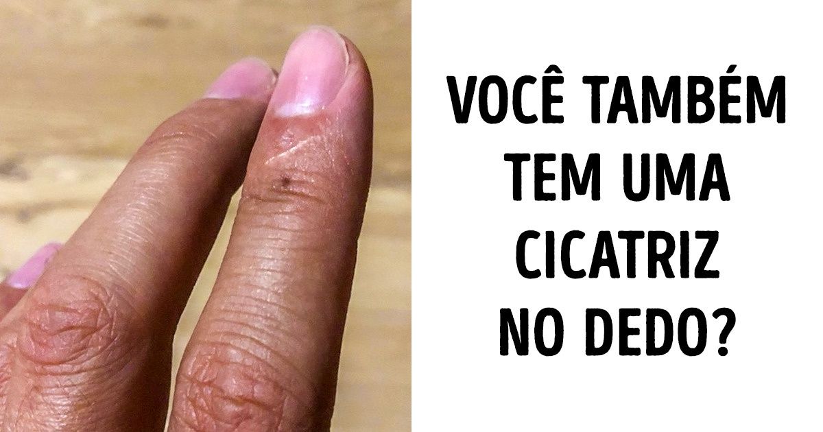 Curiosidades super esquisitas sobre o nosso corpo