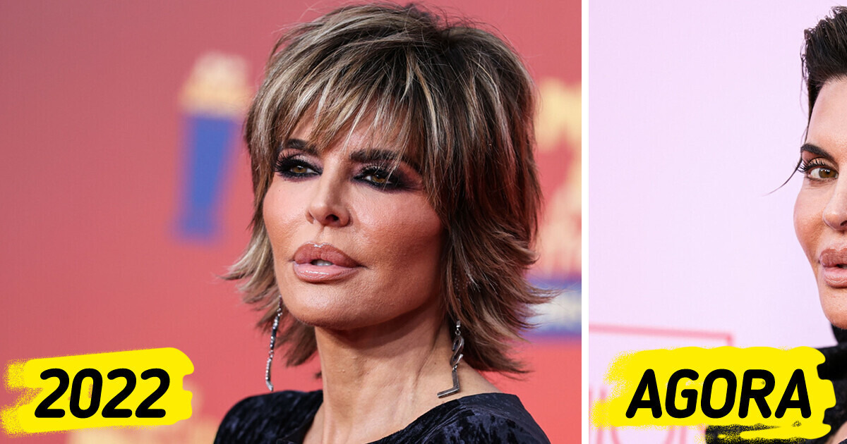 “Ela arruinou seu rosto”: Atriz Lisa Rinna surge em público e choca fãs com sua aparência