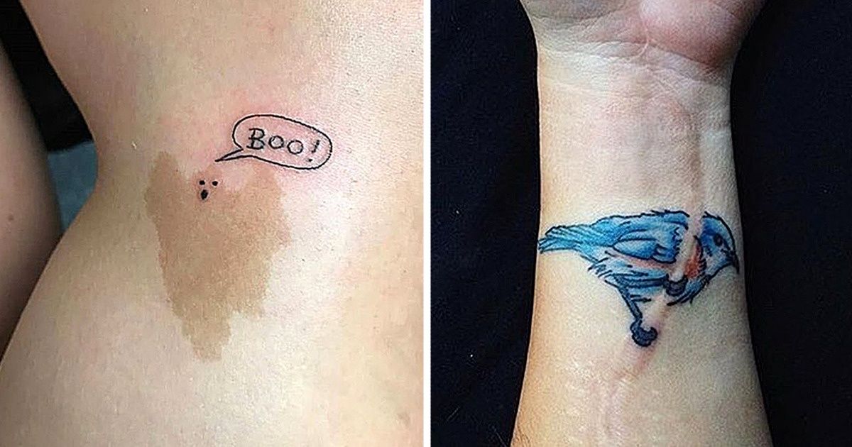 14 Pessoas que transformaram seus “defeitos” de pele com tatuagens