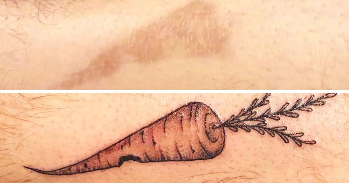 23 Tatuagens que transformaram imperfeições da pele em arte 23 Tatuagens que transformaram imperfeições da pele em arte