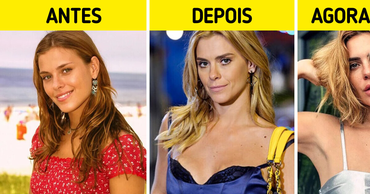 14 Celebridades que deixaram os retoques estéticos no passado 14 Celebridades que deixaram os retoques estéticos no passado