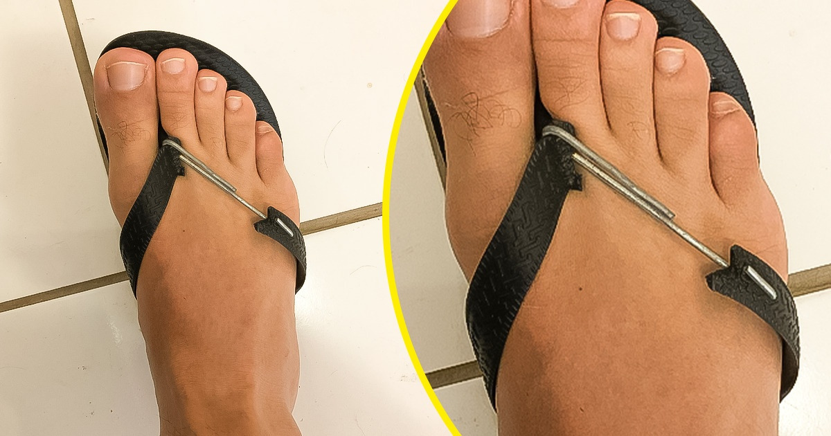 18 Pessoas que não entraram em desespero e acharam uma boa saída para os problemas do dia a dia
