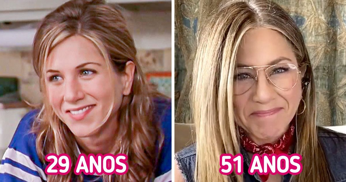 11 Famosas que rejeitam cirurgias estéticas e enaltecem rostos e corpos naturais