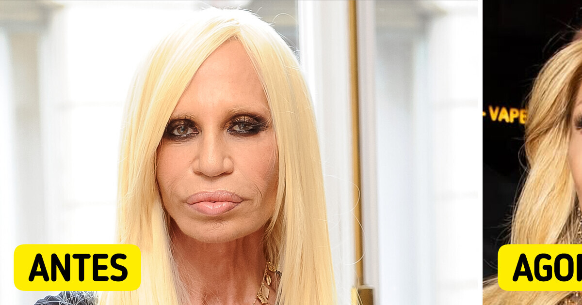 Nova fase, novo rosto: Donatella Versace rouba a cena com transformação impressionante Nova fase, novo rosto: Donatella Versace rouba a cena com transformação impressionante
