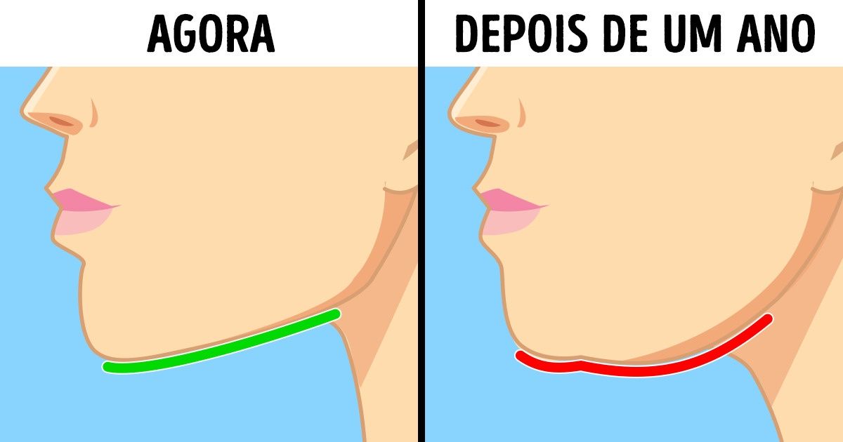 Como proteger a sua saúde da síndrome do ’pescoço de texto’