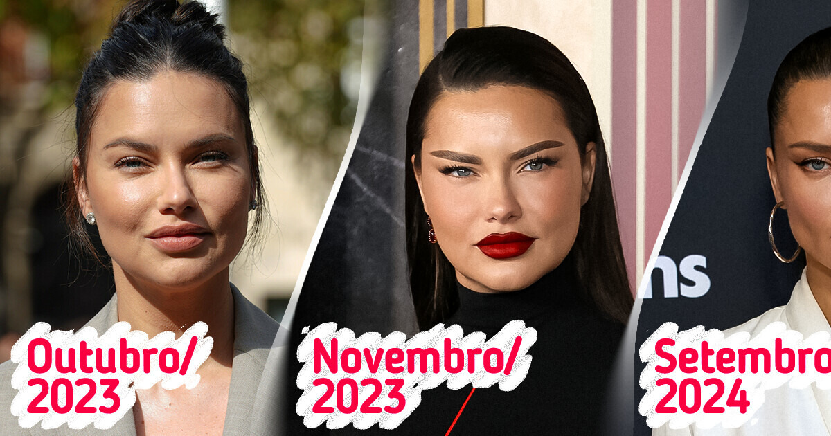 Adriana Lima responde a rumores sobre preenchimentos e desabafa: ’Sou apenas uma mãe exausta’ Adriana Lima responde a rumores sobre preenchimentos e desabafa: ’Sou apenas uma mãe exausta’