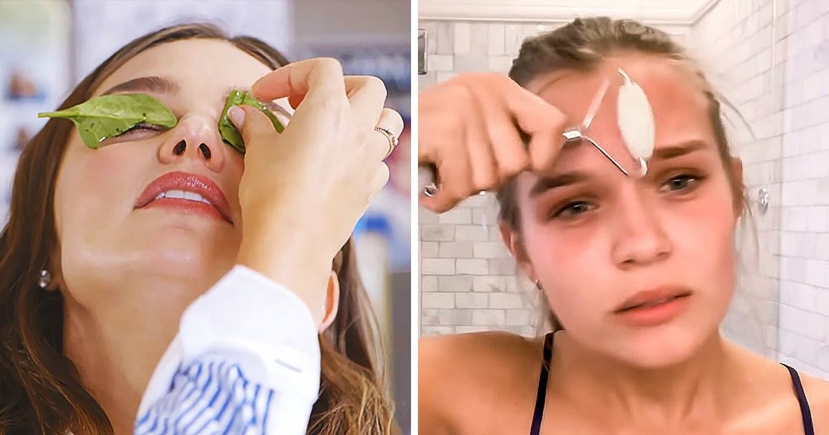 9 Técnicas contra olheiras eficientes usadas por modelos famosas