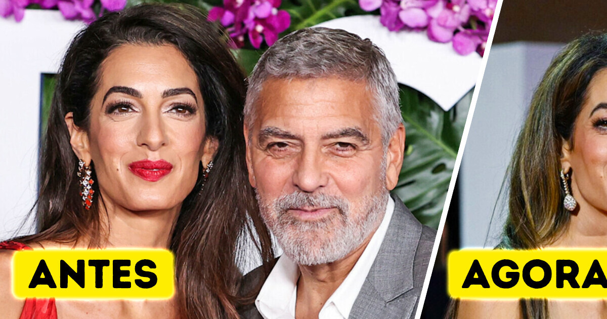 Web reage ao novo rosto da esposa de George Clooney: “Botox ou plásticas?”