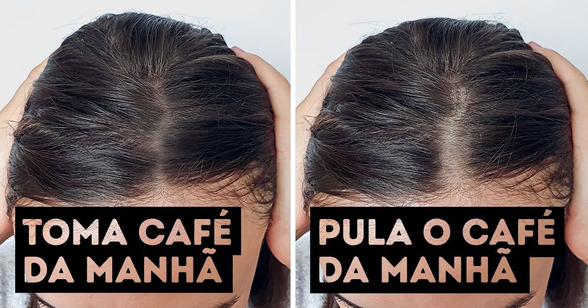 10 Hábitos cotidianos que podem provocar queda de cabelo