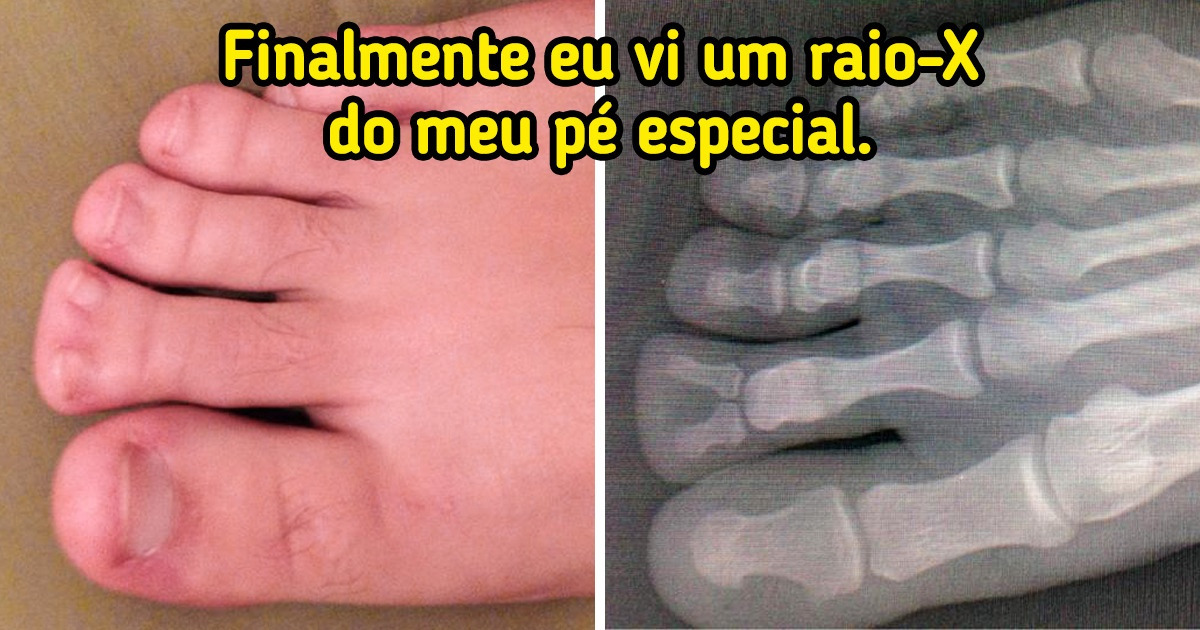 18 Pessoas que foram repentinamente surpreendidas com surpresas que menos esperavam