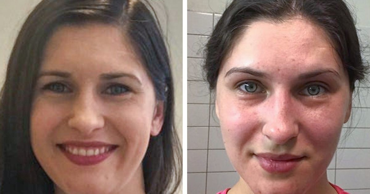 20 Mulheres cujos “defeitos” são na verdade características que as tornam únicas