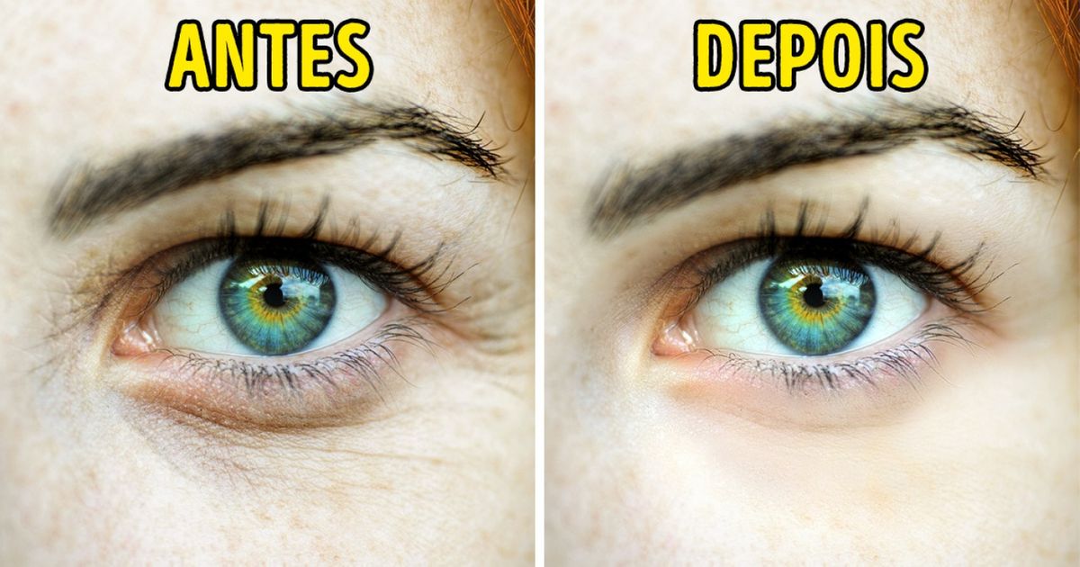 Conheça algumas formas para reduzir as rugas naturalmente