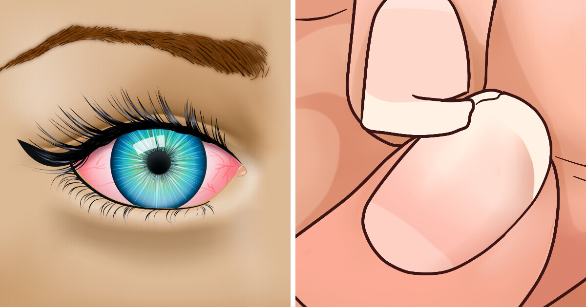 10 Sintomas que aparecem quando a tireoide das mulheres não está funcionando bem 10 Sintomas que aparecem quando a tireoide das mulheres não está funcionando bem