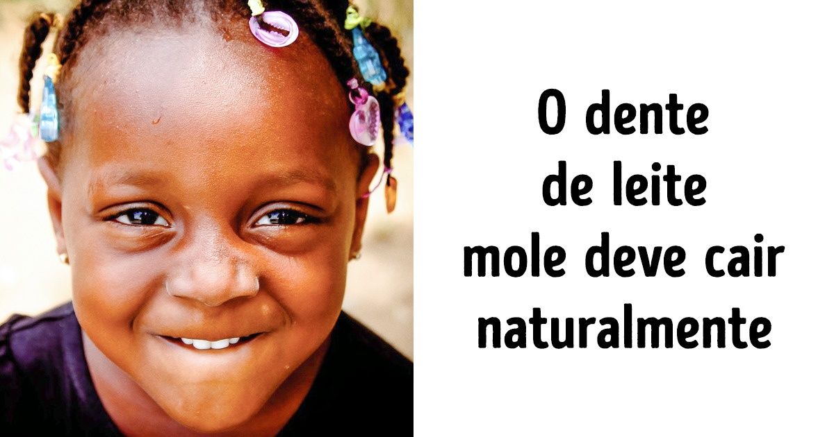 10 Mitos e verdades sobre dente de leite e orientações para que eles tenham um sorriso saudável 10 Mitos e verdades sobre dente de leite e orientações para que eles tenham um sorriso saudável