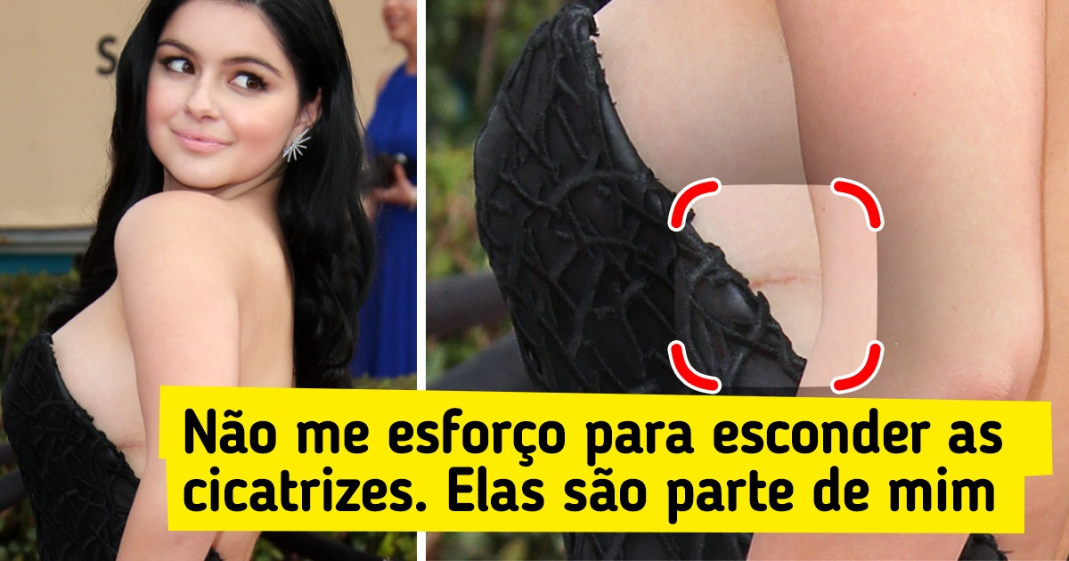 10 Estrelas que já mostraram suas “imperfeições” em fotos e nos inspiram a ter orgulho de quem somos