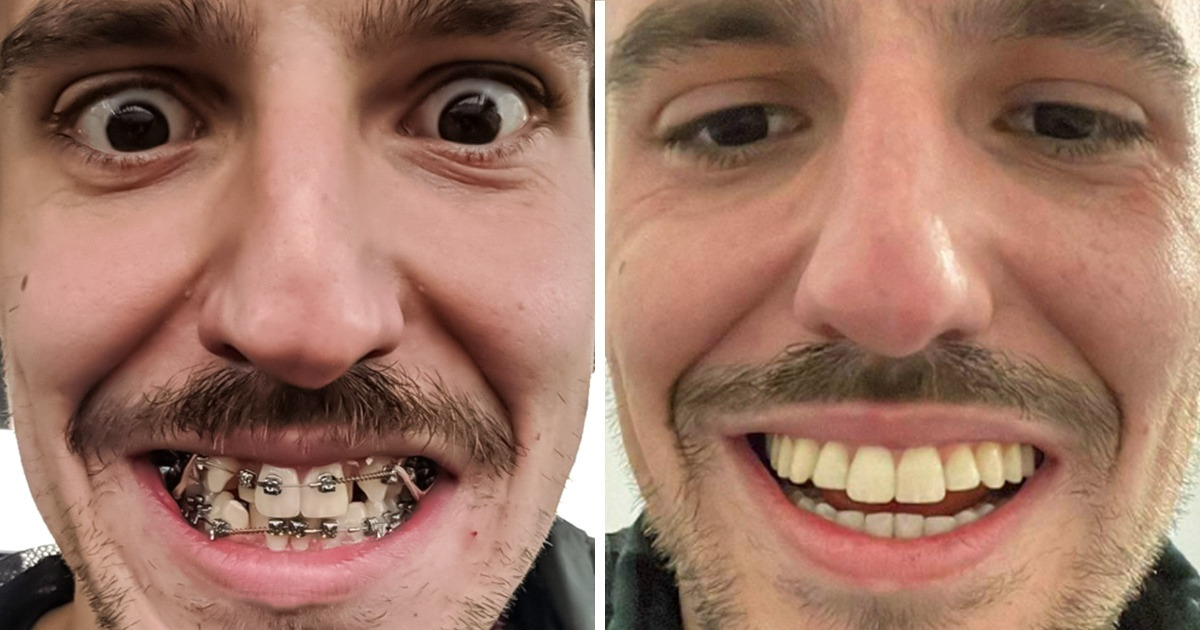 18 Provas de que uma pessoa pode ficar ainda melhor com um sorriso perfeito 18 Provas de que uma pessoa pode ficar ainda melhor com um sorriso perfeito