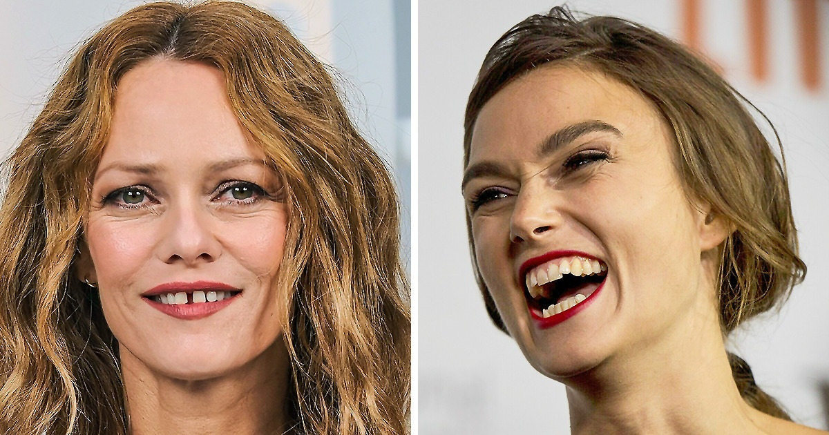 16 Celebridades que aceitaram seus charmosos sorrisos “imperfeitos” 16 Celebridades que aceitaram seus charmosos sorrisos “imperfeitos”