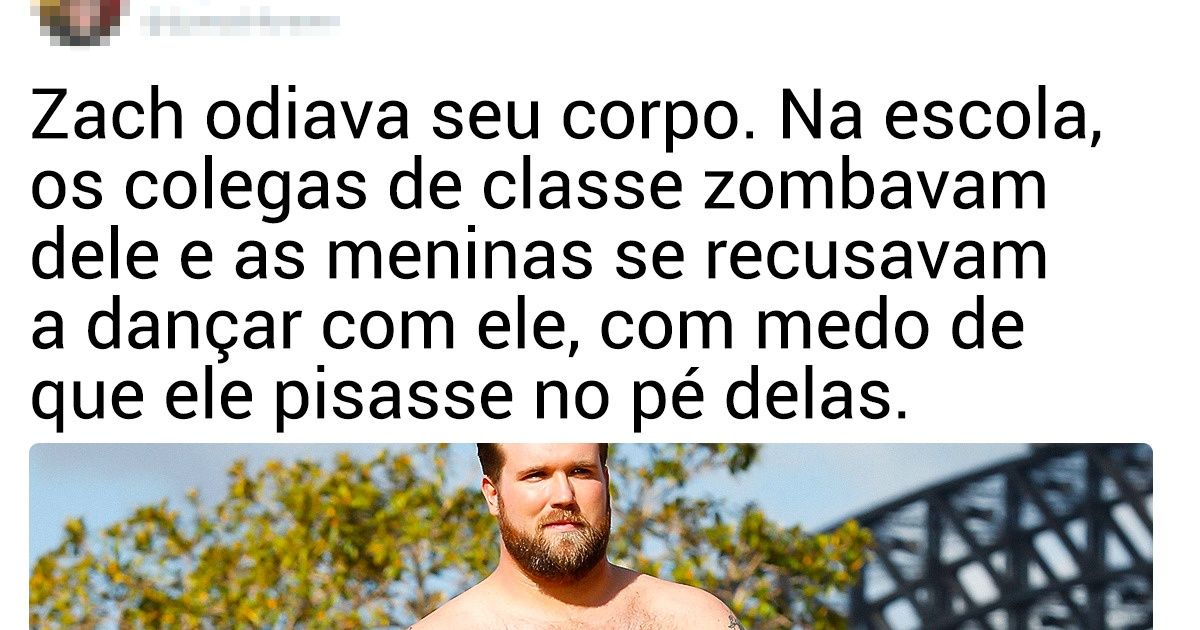14 Modelos cuja beleza única e fora do padrão está conquistando as passarelas e os fãs ao redor do mundo
