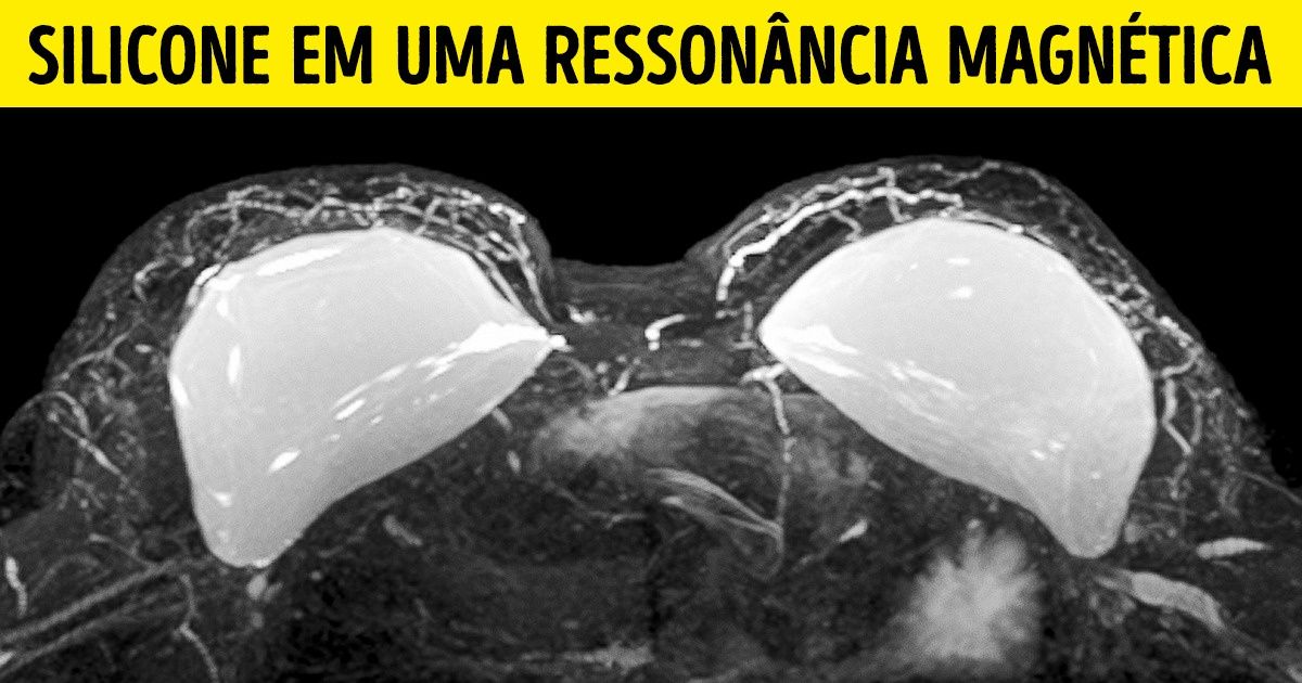 20+ Imagens surpreendentes de diagnósticos médicos que mostram como o corpo humano é incrível 20+ Imagens surpreendentes de diagnósticos médicos que mostram como o corpo humano é incrível