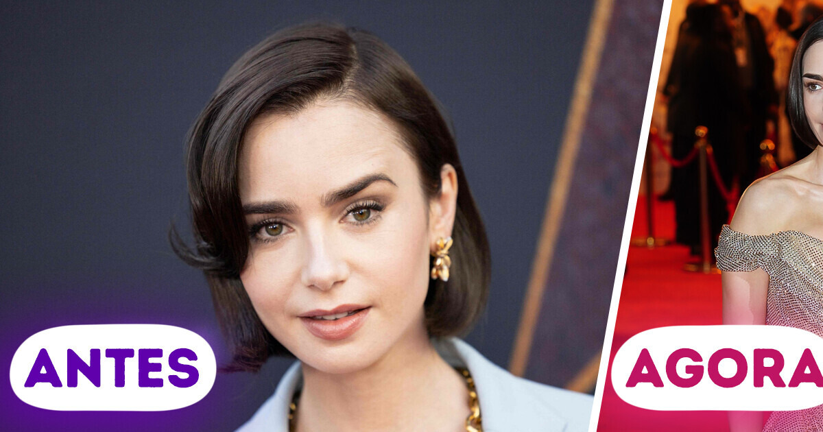 Novo visual de Lily Collins causa polêmica e o silicone está no centro do debate