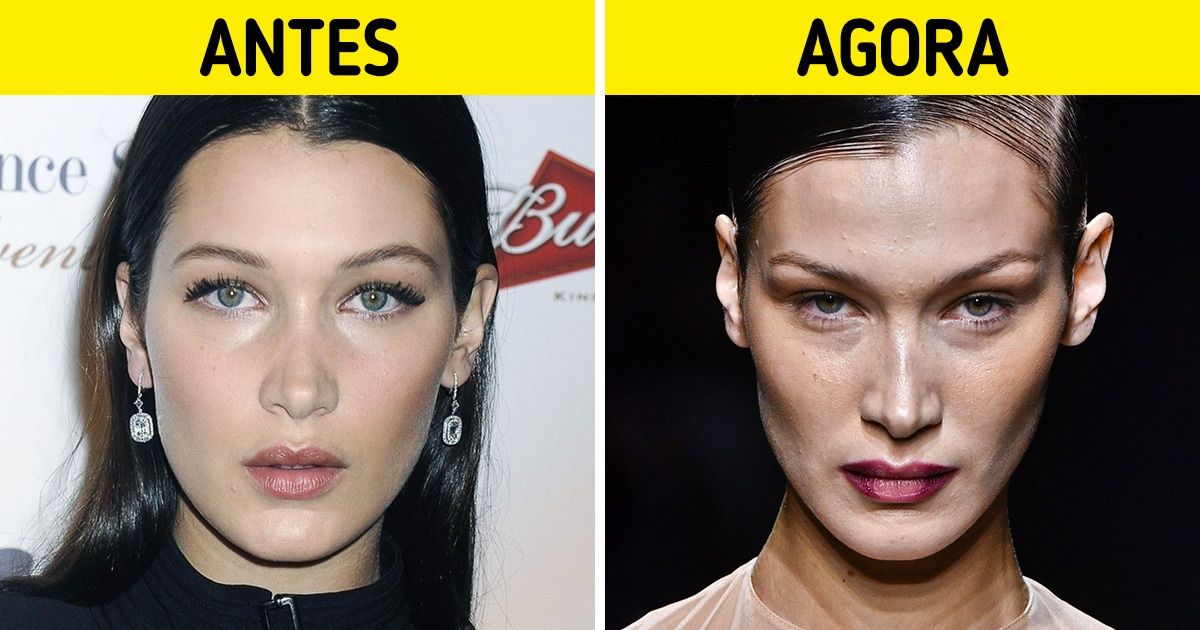 17 Celebridades cujas bochechas rechonchudas deram lugar a maçãs do rosto esculpidas 17 Celebridades cujas bochechas rechonchudas deram lugar a maçãs do rosto esculpidas