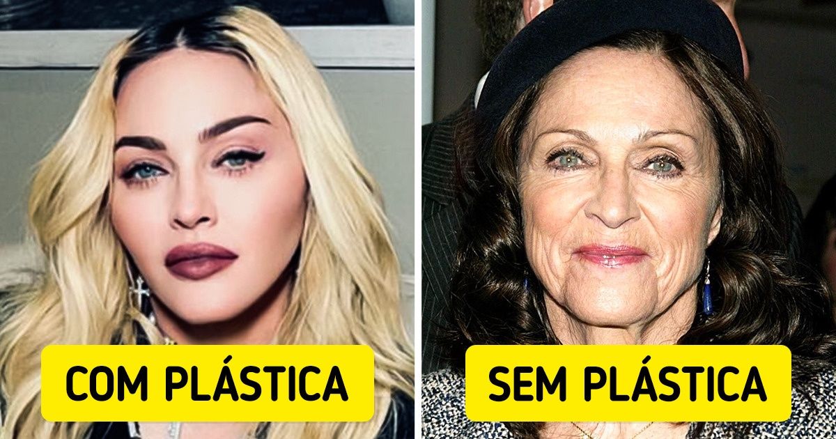 Como 10 famosos poderiam estar se tivessem deixando a natureza seguir seu curso