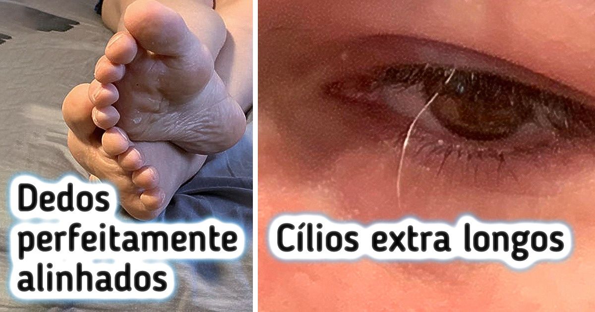 16 Pessoas que nasceram com características realmente únicas 16 Pessoas que nasceram com características realmente únicas