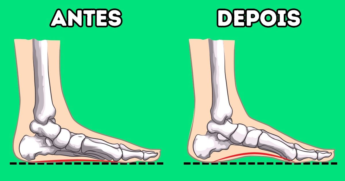7 Exercícios recomendados por ortopedistas para normalizar a curvatura do pé e diminuir dores 7 Exercícios recomendados por ortopedistas para normalizar a curvatura do pé e diminuir dores