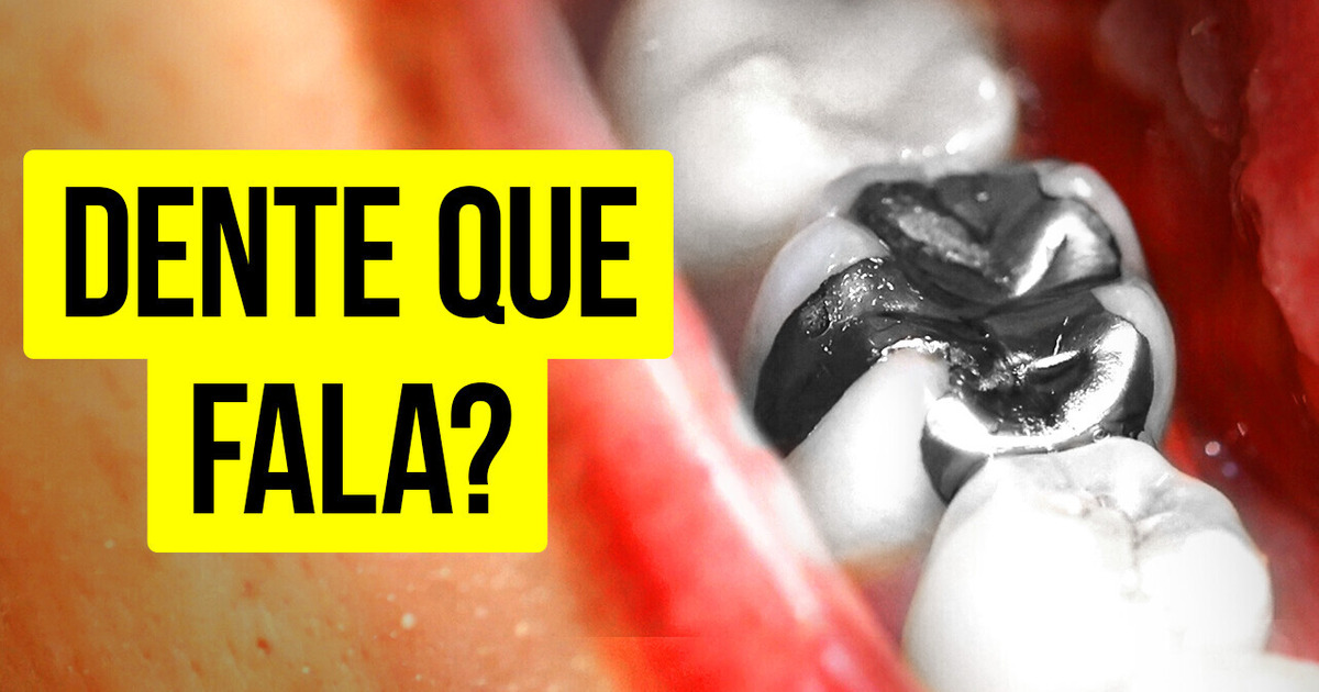 Esta mulher ouviu sinais de rádio através de um dente