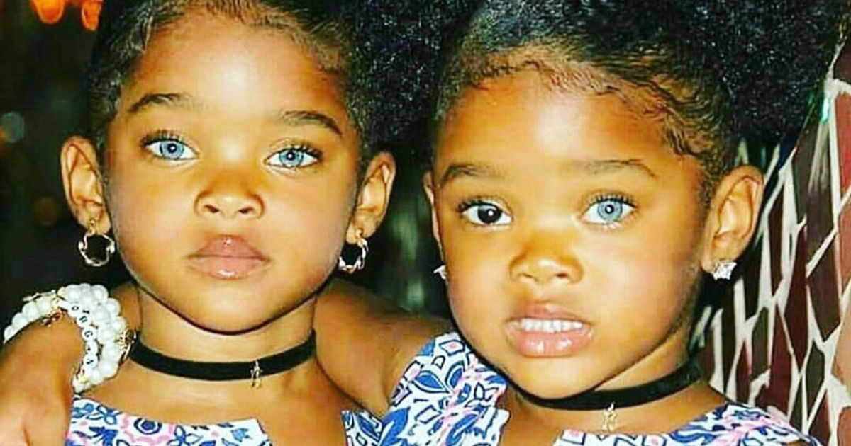 24 Pessoas com uma beleza totalmente incrível e diferente 24 Pessoas com uma beleza totalmente incrível e diferente