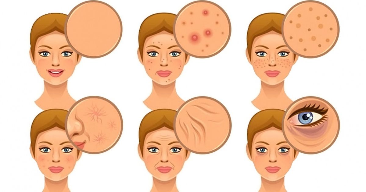 7 Alimentos que podem ser prejudiciais à sua pele